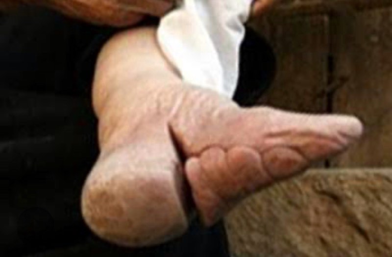 纏足(テンソク)って知ってる？