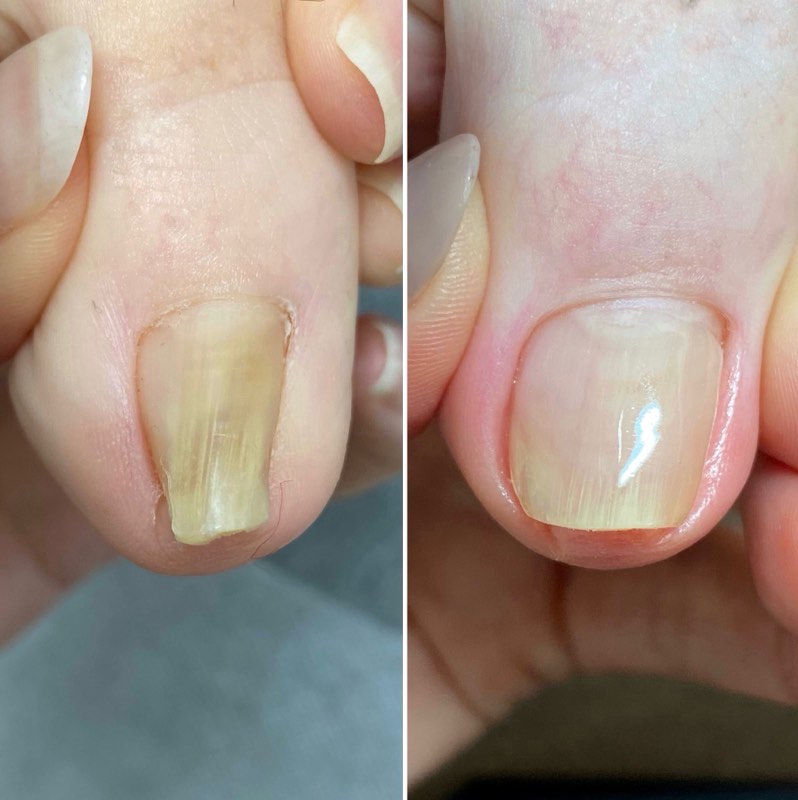 巻いた爪はジェルで・・・