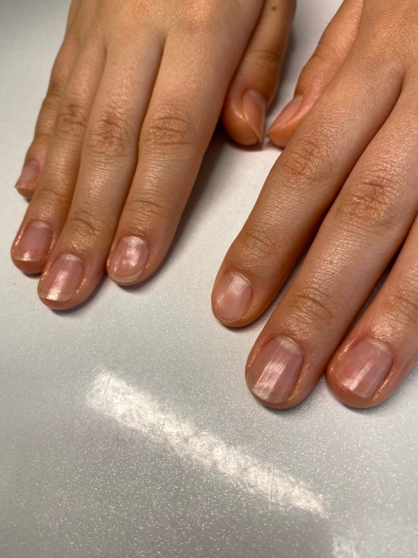 爪噛み癖がやめられた