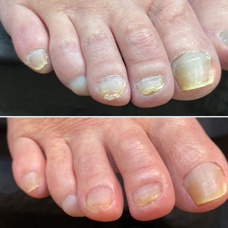 当サロンのフットケア内容と料金